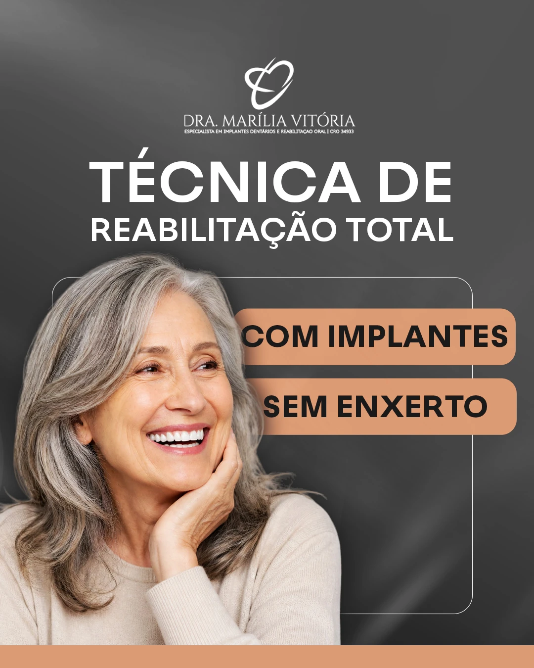Você sabia que, em alguns casos, é possível realizar implantes de todos os dentes sem enxerto?